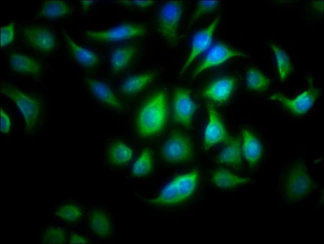 100UG ALOX15B ANTIBODY 100 ug