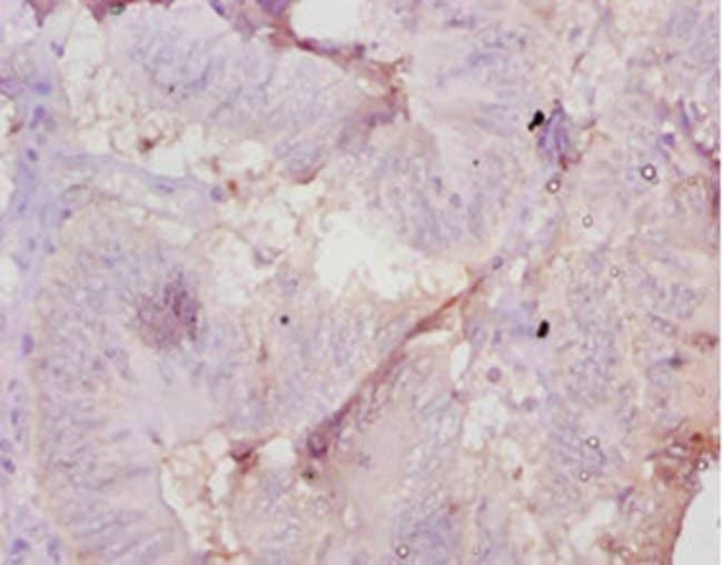 100UG AMH ANTIBODY 100 ug