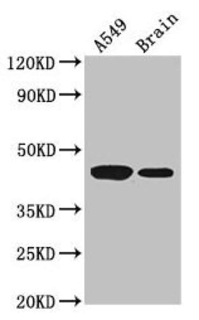 100UG AMT ANTIBODY 100 ug
