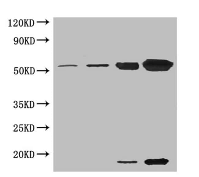 100UG RCA ANTIBODY 100 ug