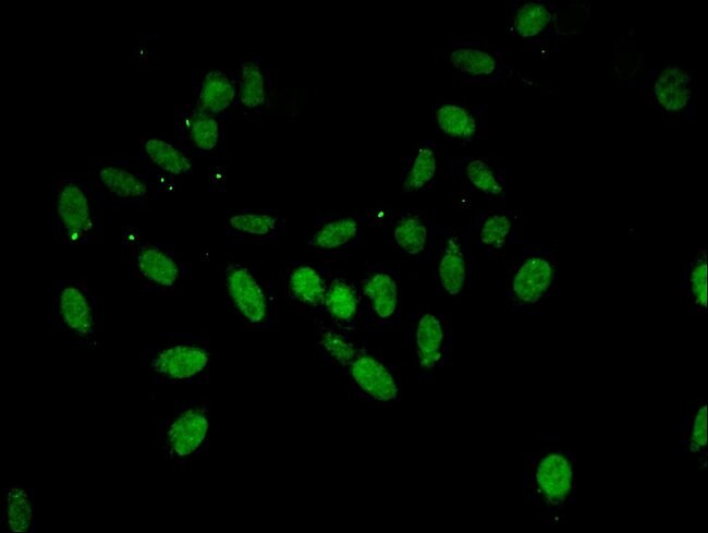 100UL ANNEXIN A11 ANTIBODY 100 ul