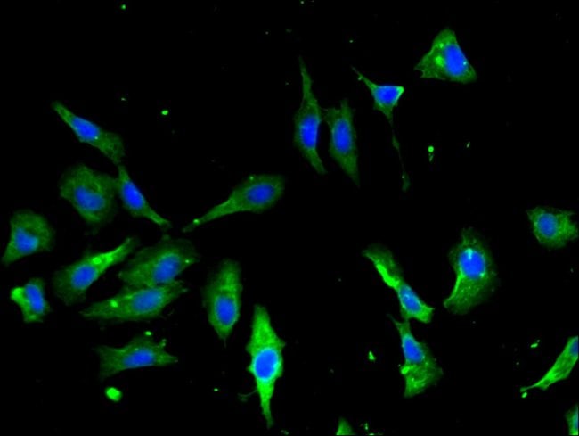 100UG ANNEXIN A2 ANTIBODY 100 ug