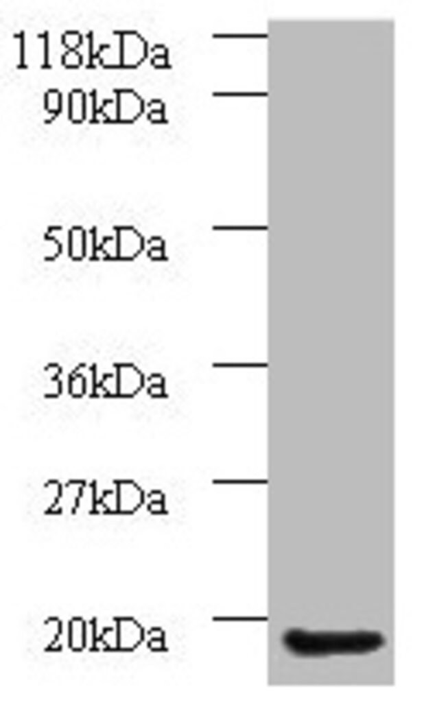 100UG AP1S3 ANTIBODY 100 ug