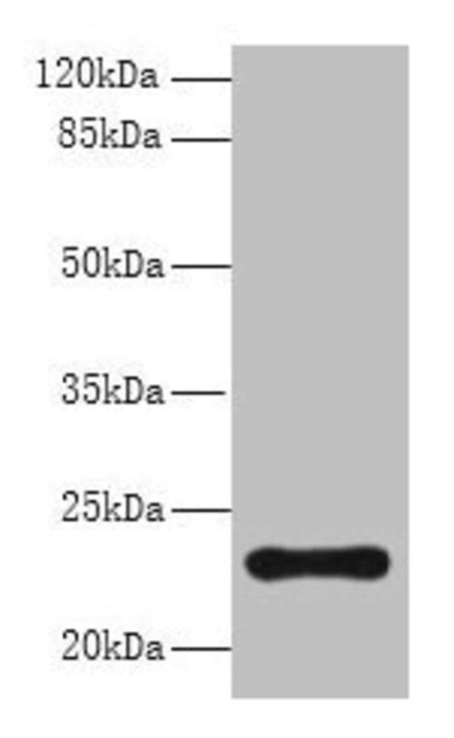 100UG AP3S2 ANTIBODY 100 ug