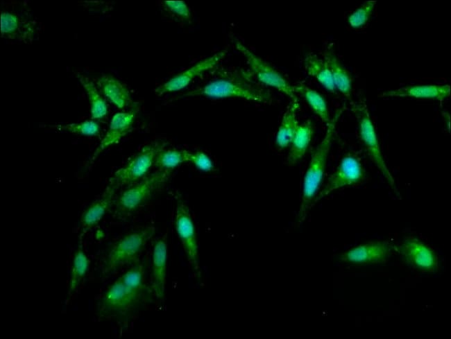 100UG ARL1 ANTIBODY 100 ug