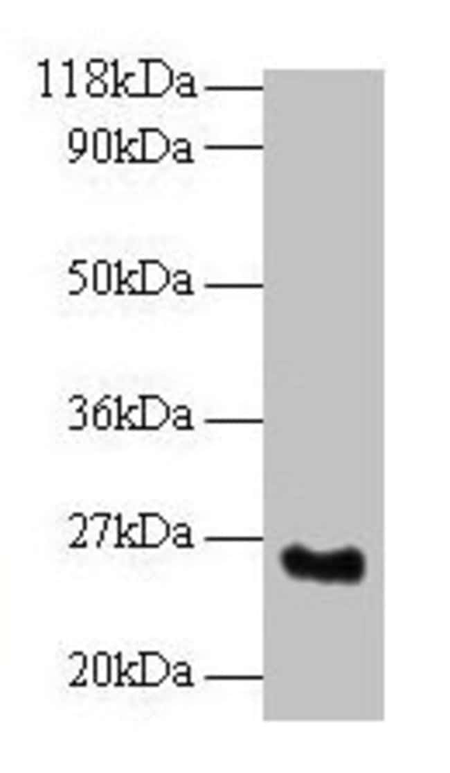100UG SRSF9 ANTIBODY 100 ug