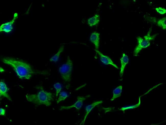 100UG ASAH2 ANTIBODY 100 ug