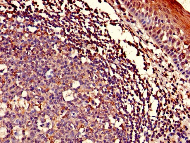 100UG ASCC1 ANTIBODY 100 ug