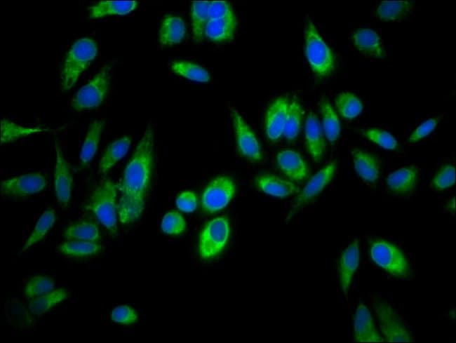100UG ASPH ANTIBODY 100 ug
