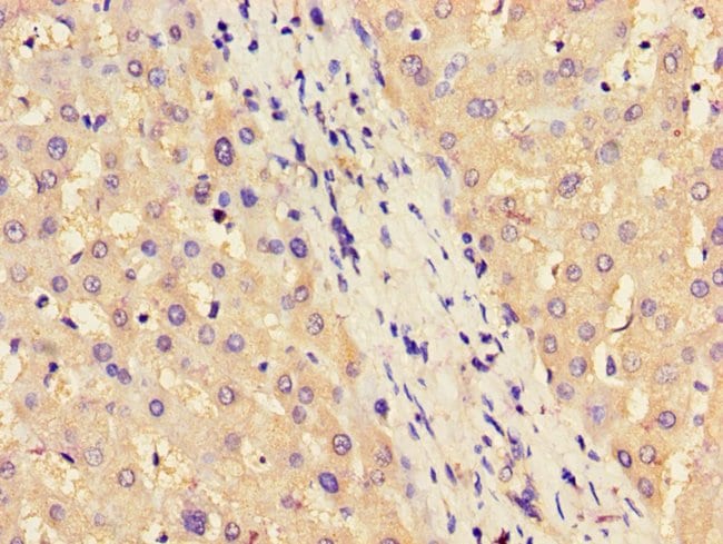 100UG ASS1 ANTIBODY 100 ug