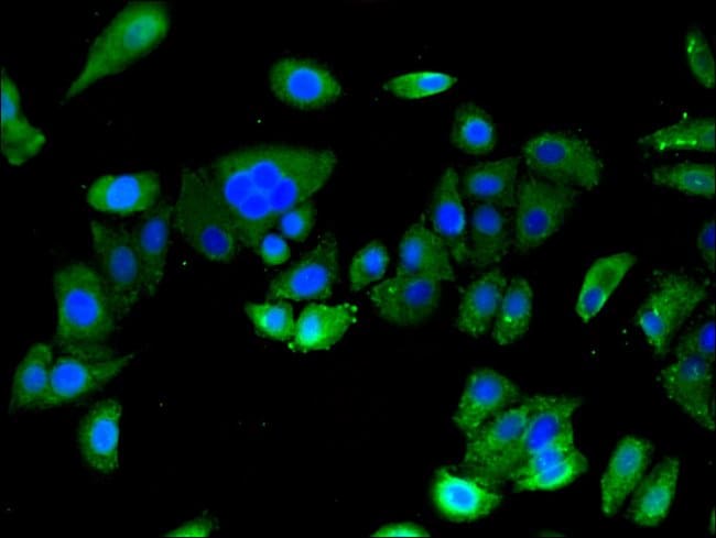 100UG ASTN2 ANTIBODY 100 ug