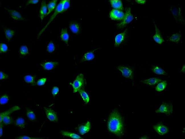 100UG ATG7 ANTIBODY 100 ug