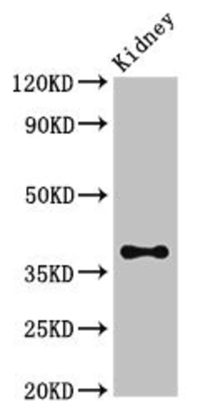 100UG MATH1 ANTIBODY 100 ug