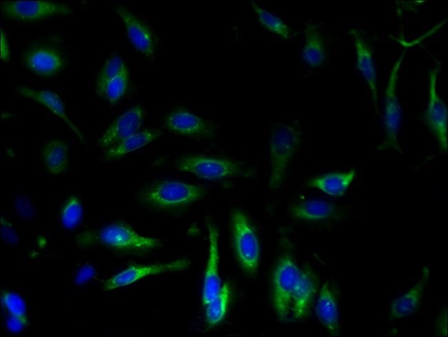 100UG SERCA2 ATPASE ANTIBODY 100 ug