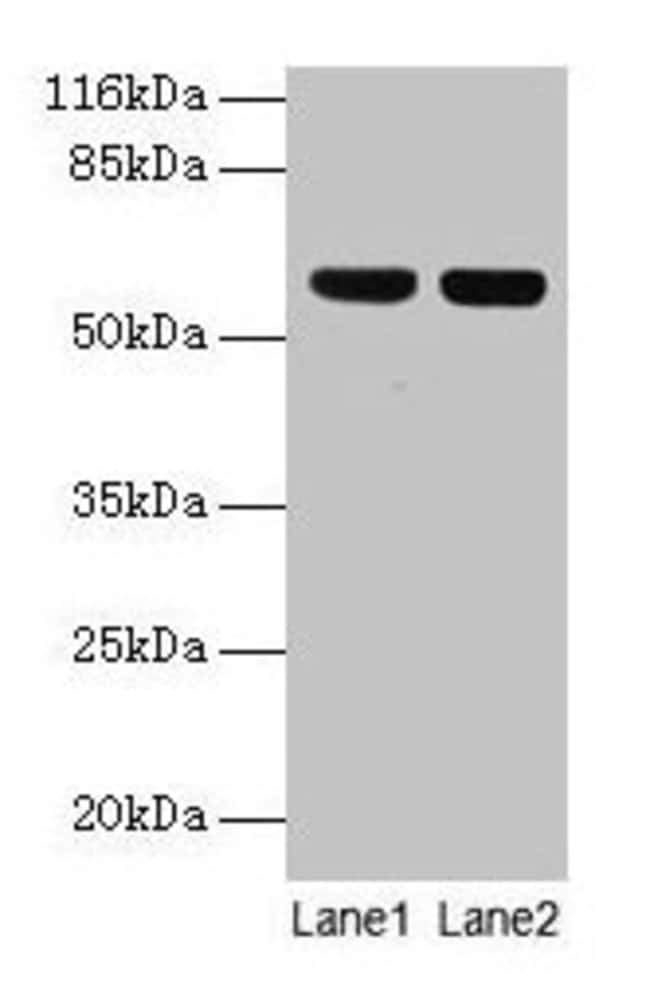 100UG ATP5A1 ANTIBODY 100 ug