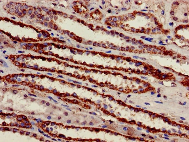 100UG ATP SYNTHASE BETA ANTIBODY 100 ug