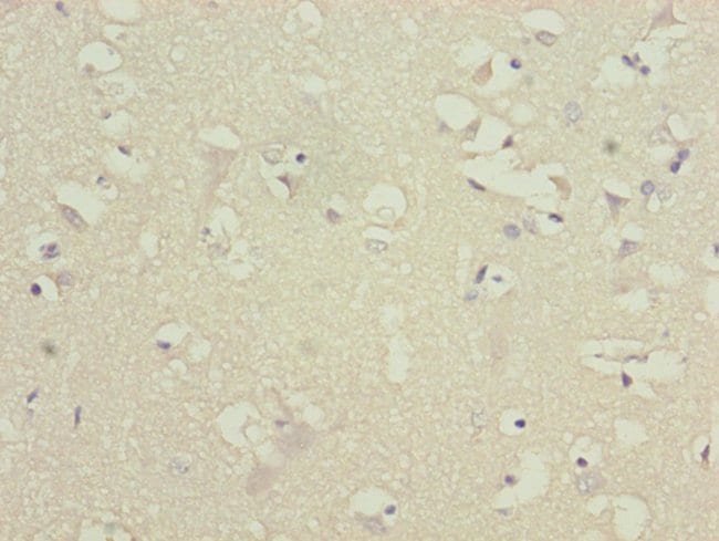 100UL ATP5D ANTIBODY 100 ul