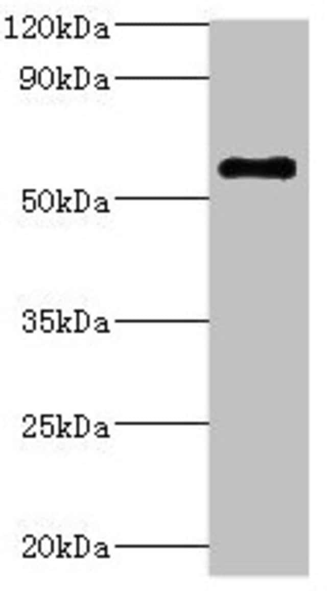 100UL ATP6V1B2 ANTIBODY 100 ul