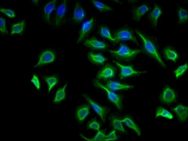 100UG ATP6V1G2 ANTIBODY 100 ug