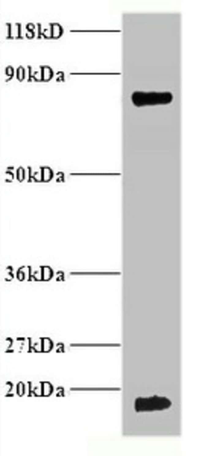 100UG HEMOGLOBIN ANTIBODY 100 ug