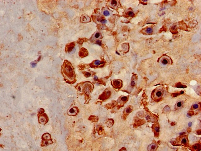 100UG AZIN1 ANTIBODY 100 ug