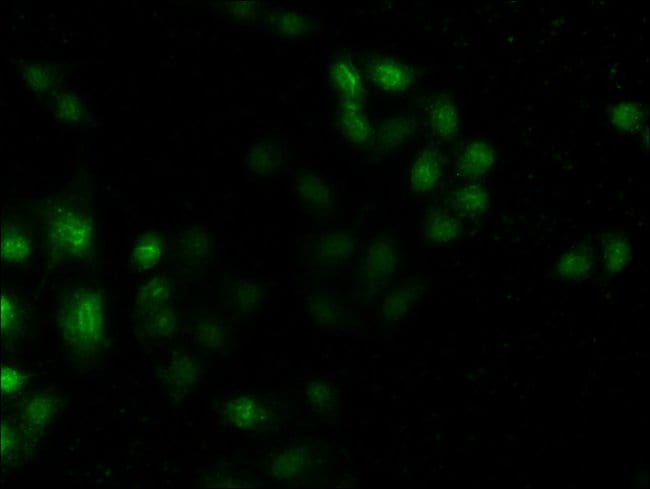 100UG MST3 ANTIBODY 100 ug