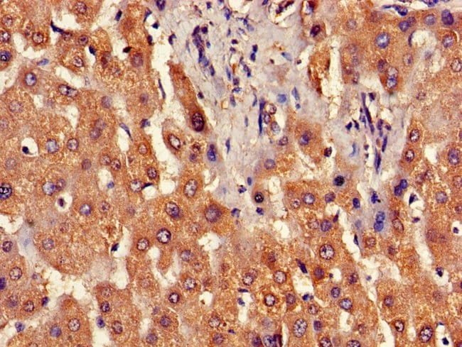 100UG B3GNT2 ANTIBODY 100 ug