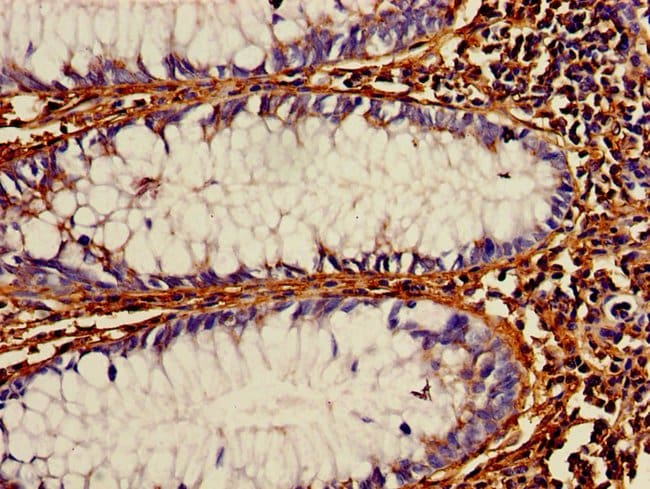 100UG PDI ANTIBODY 100 ug