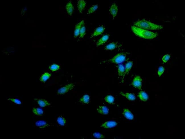 100UG P130CAS ANTIBODY 100 ug