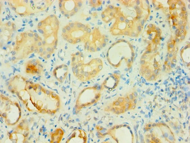 100UL BCAT2 ANTIBODY 100 ul