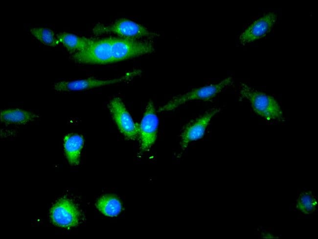100UG BUTYRYLCHOLINESTERASE ANTIBODY 100