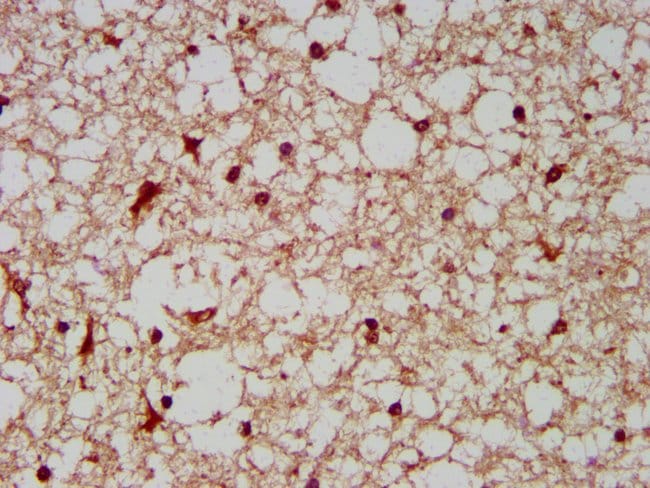 100UG BCKDHA ANTIBODY 100 ug