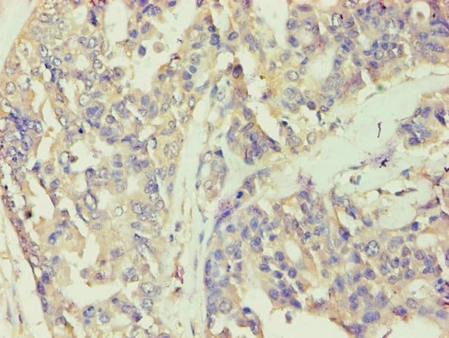 100UL BCKDK ANTIBODY 100 ul