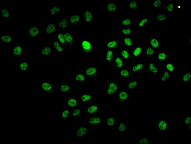 100UG BCL9 ANTIBODY 100 ug