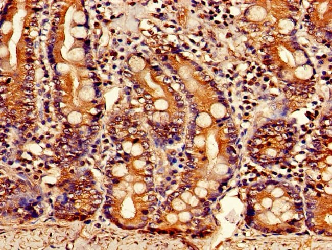100UG BDH1 ANTIBODY 100 ug