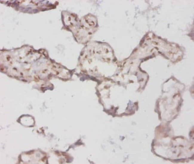 100UG BMP-3 ANTIBODY 100 ug