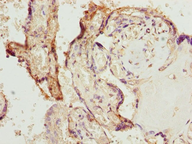 100UL BISPHOSPHOGLYCERATE MUTASE ANT 100