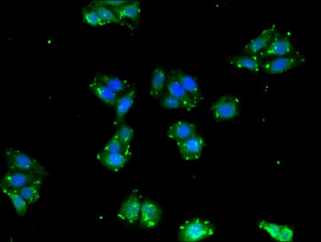100UG BPI ANTIBODY 100 ug