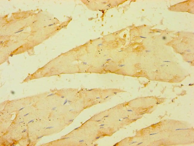 100UL BRCC3 ANTIBODY 100 ul