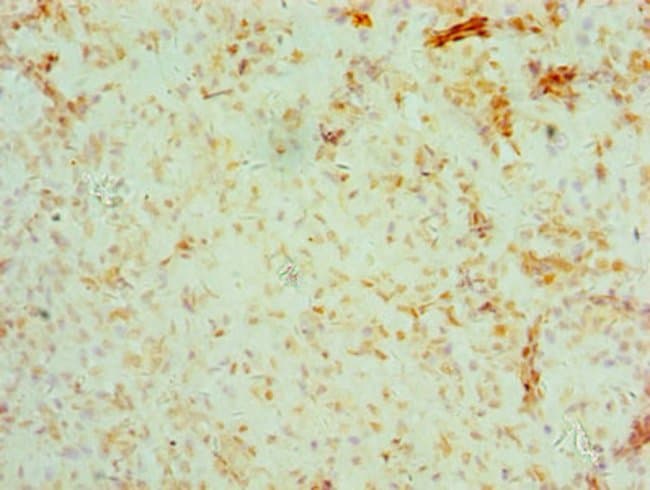 100UG BRCC3 ANTIBODY 100 ug