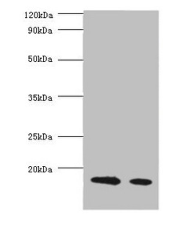 100UG BETA LACTOGLOBULIN ANTIBODY 100 ug