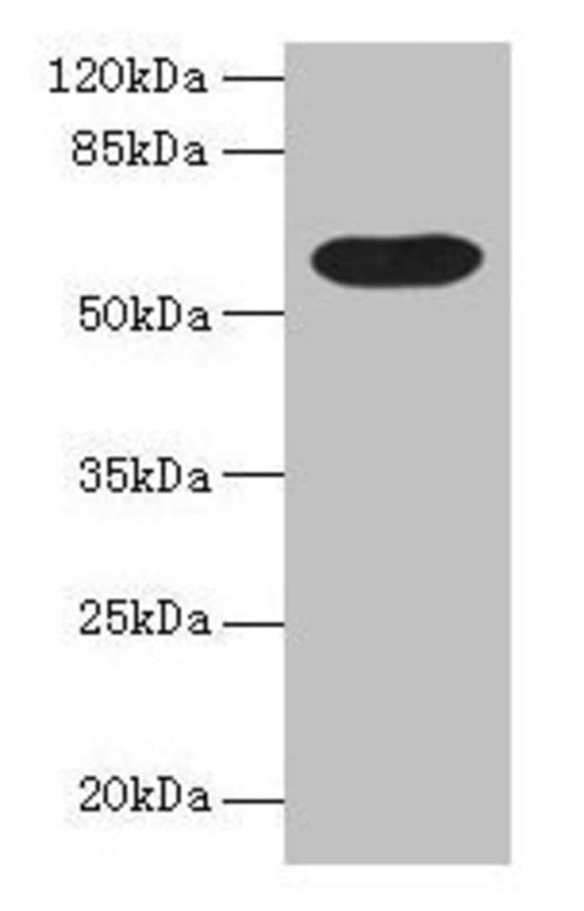 100UG BTN3A1 ANTIBODY 100 ug