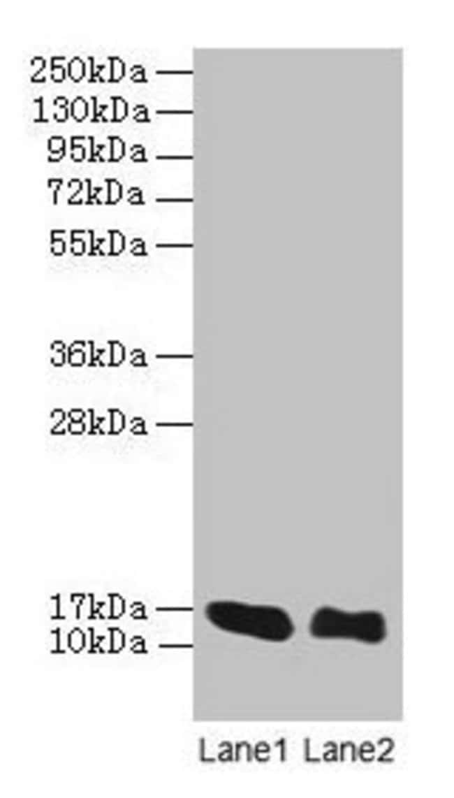 100UG LINC01553 ANTIBODY 100 ug