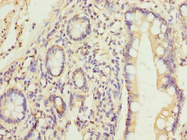 100UG HEATR9 ANTIBODY 100 ug