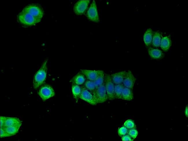 100UG GPI ANTIBODY 100 ug