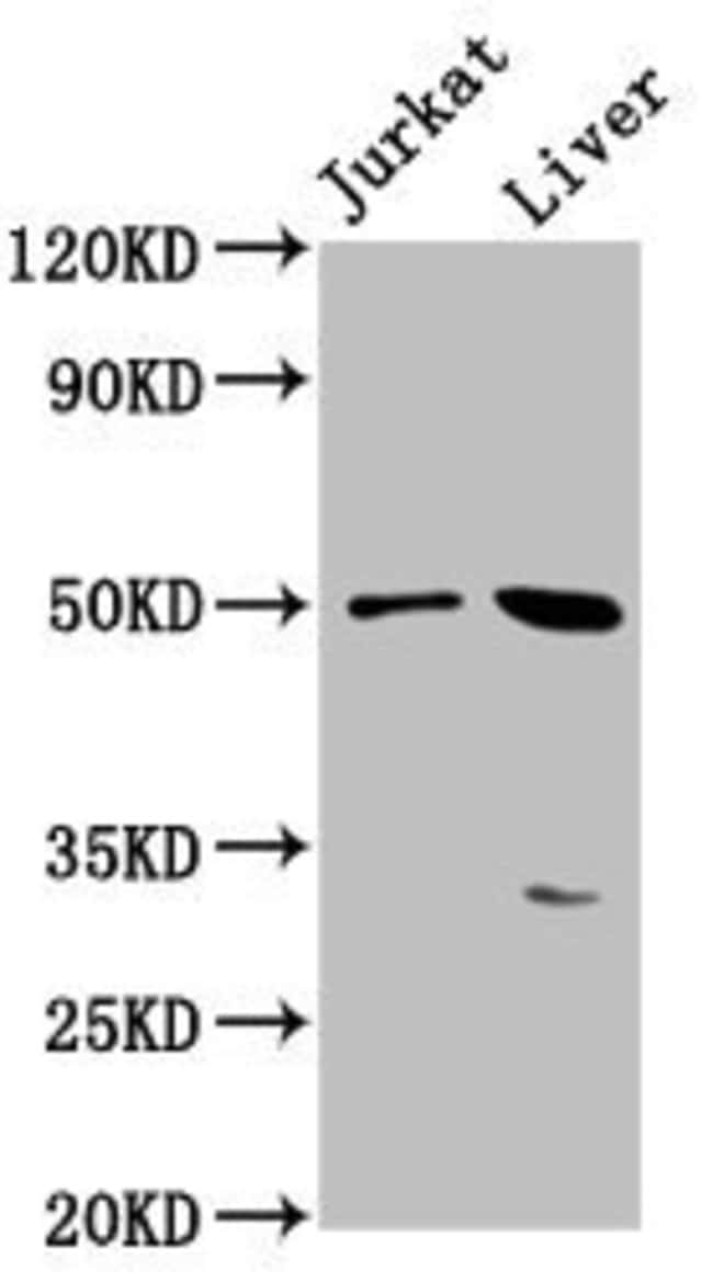 100UG BPIFB3 ANTIBODY 100 ug