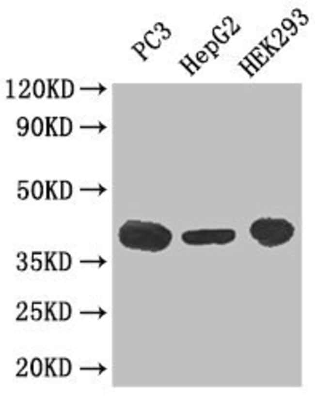 100UG C5AR1 ANTIBODY 100 ug