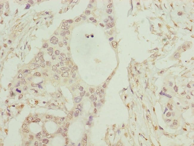 100UL C8B ANTIBODY 100 ul