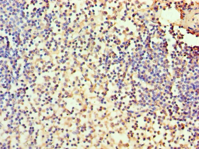 100UL CARBONIC ANHYDRASE I ANTIBODY 100