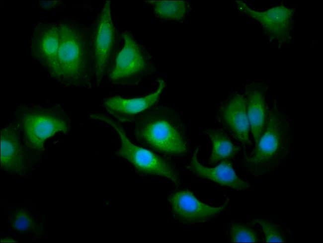 100UG CARBONIC ANHYDRASE I ANTIBODY 100